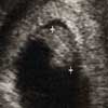 first sonogram